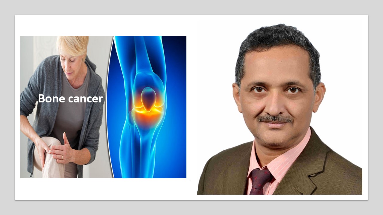 Best Bone Cancer Doctor In Ahmedabad